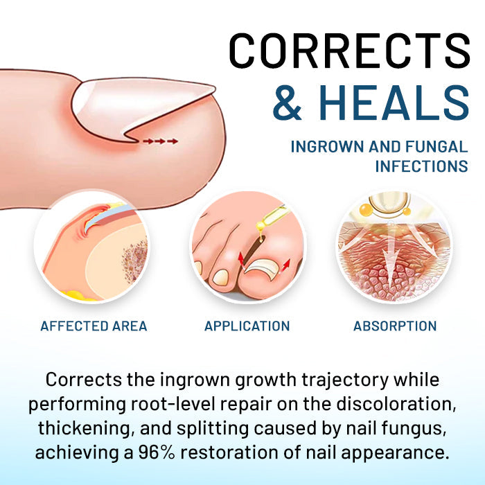 Total Nail Nano-Repair Solution
