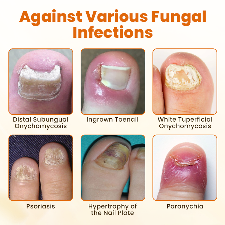 Advanced Nail Repair Spray