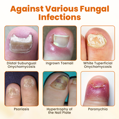 Advanced Nail Repair Spray