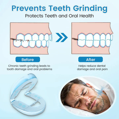 Anti-Snoring & Teeth Grinding Mouth Guard