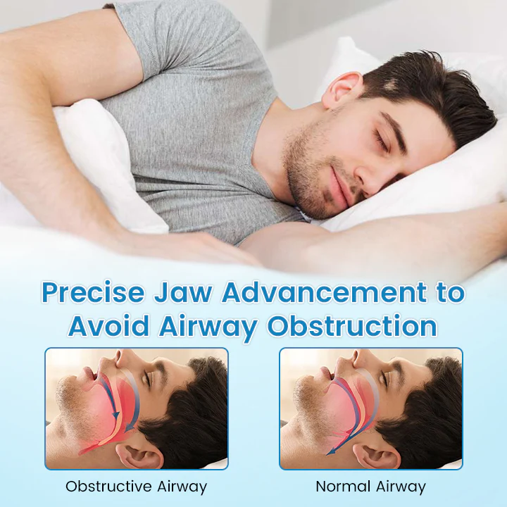 Anti-Snoring & Teeth Grinding Mouth Guard