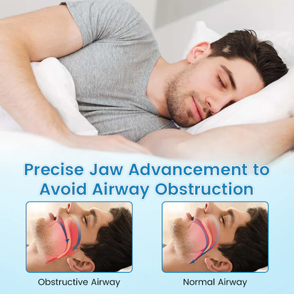 Anti-Snoring & Teeth Grinding Mouth Guard