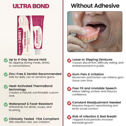 Ultra Bond Denture Adhesive