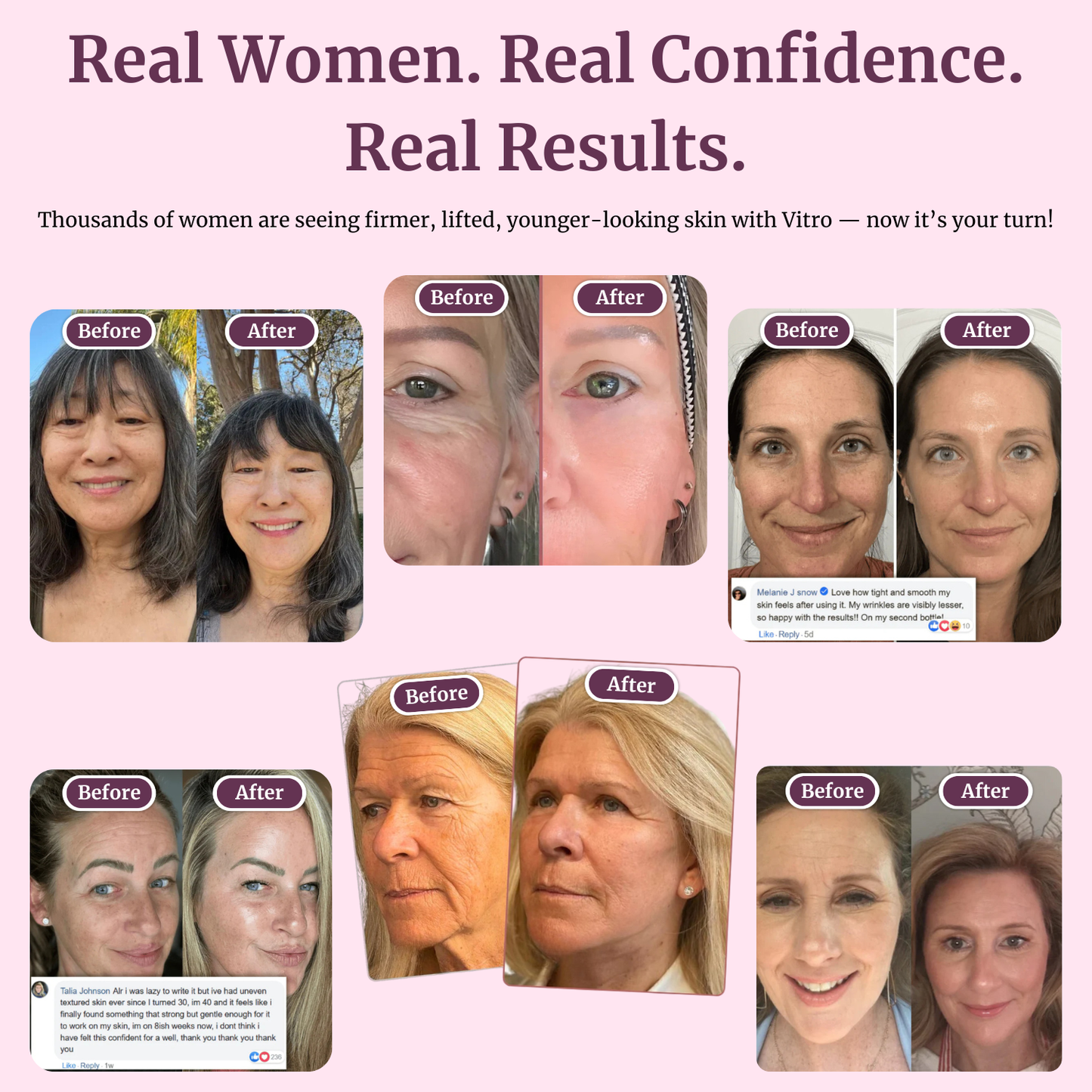 Youth Renewal Multi Balm